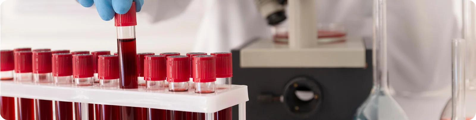 Toma de muestra de sangre en laboratorio